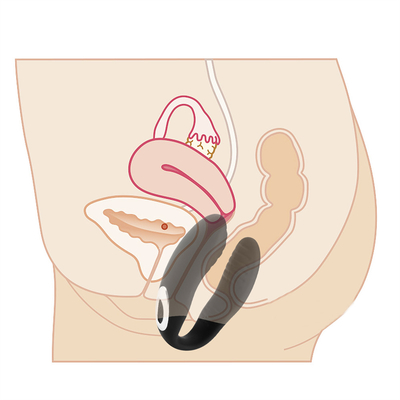 Vibrator de masaje vaginal de control remoto Vibrator de clítoris invisible